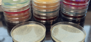 Developments in Understanding Diastaticus
