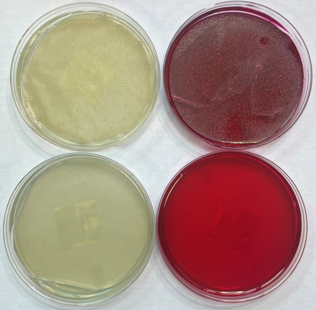 Sta1 Developments in Understanding Diastaticus - Wyeast Lab