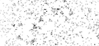 Wyeast Lab Report: Understanding Diastaticus